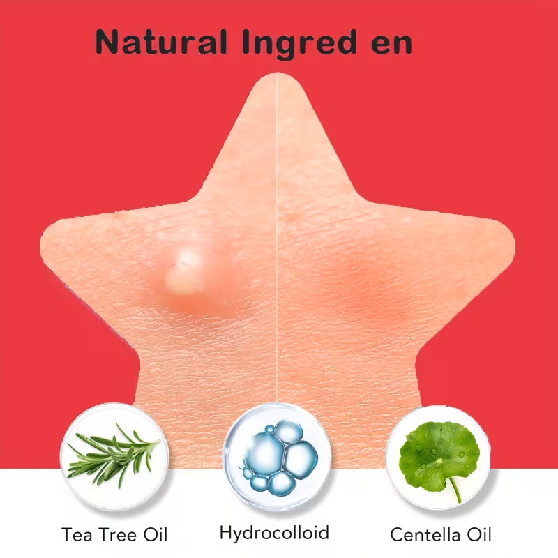 200/400 Parches para Acné de T - Skincare Oil Control reseña y precio