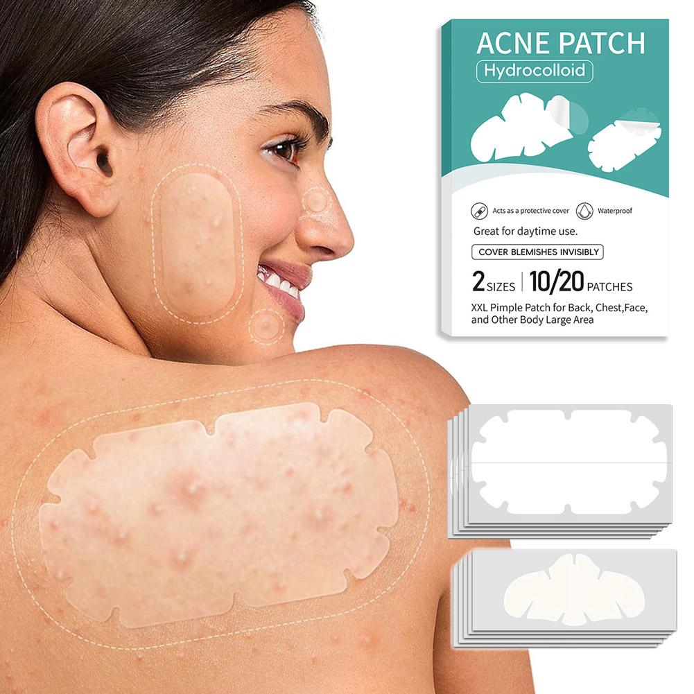 Parche para acné combinado de  - Skincare Oil Control reseña y precio